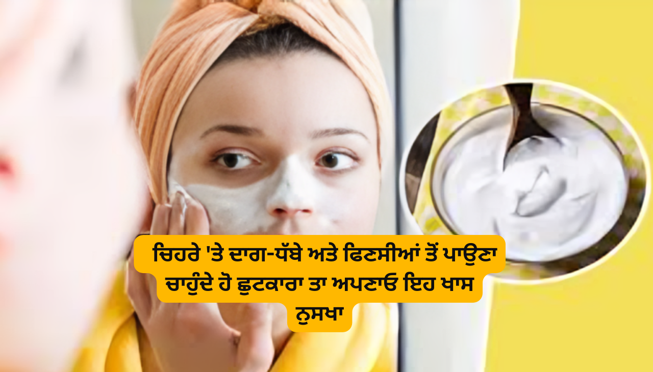 ਚਿਹਰੇ 'ਤੇ ਦਾਗ-ਧੱਬੇ ਅਤੇ ਫਿਣਸੀਆਂ ਤੋਂ ਪਾਉਣਾ ਚਾਹੁੰਦੇ ਹੋ ਛੁਟਕਾਰਾ ਤਾ ਅਪਣਾਓ ਇਹ ਖਾਸ ਨੁਸਖਾ