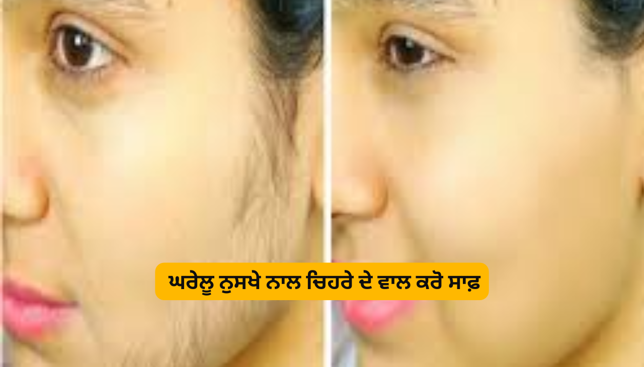 ਘਰੇਲੂ ਨੁਸਖੇ ਨਾਲ ਚਿਹਰੇ ਦੇ ਵਾਲ ਕਰੋ ਸਾਫ਼